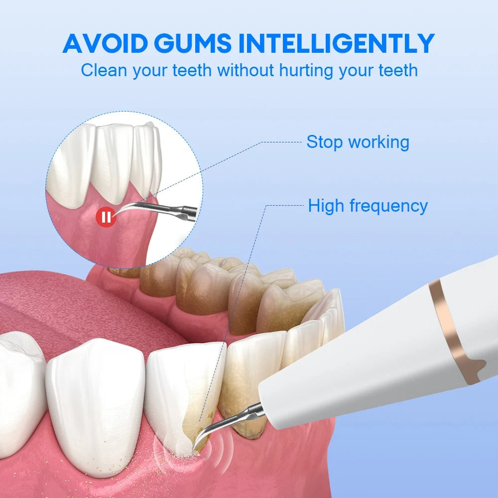 Ultrasonic Toothbrush