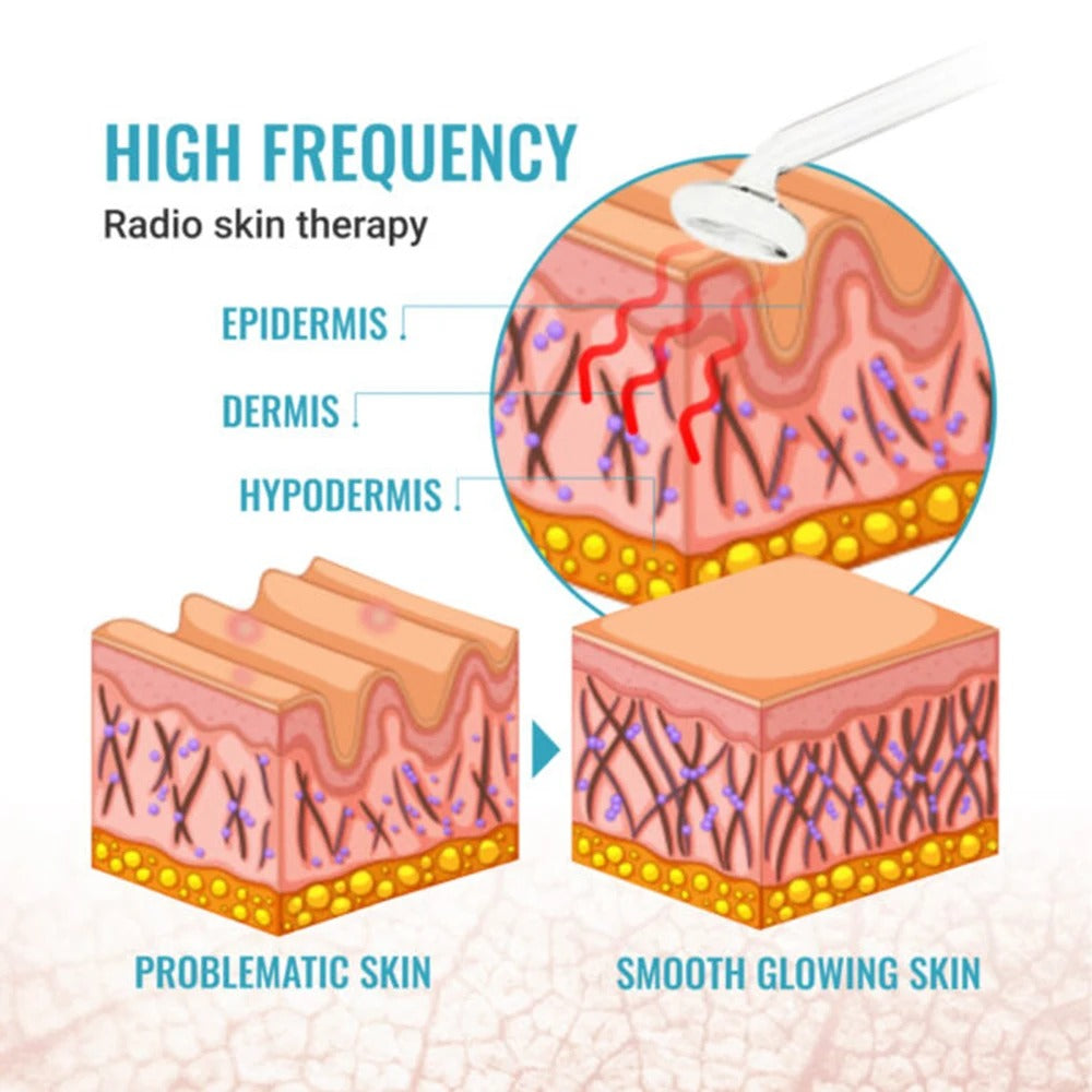 High Frequency Skin Wand